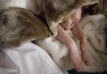 Pigmenti Bild von Pigmenti